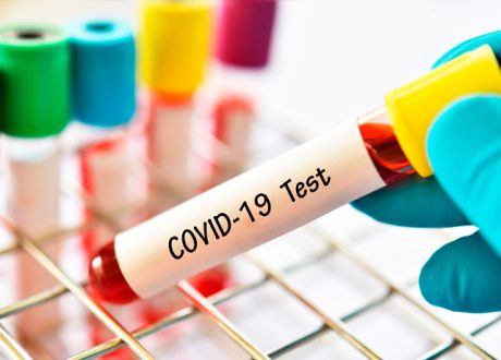 Seguros de saúde vão cobrir testes ao coronavírus